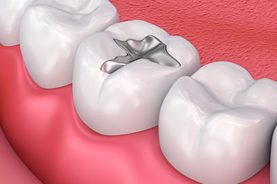 M. Derek Davis, DDS | Laser Dentistry, Teeth Whitening and Preventative Program