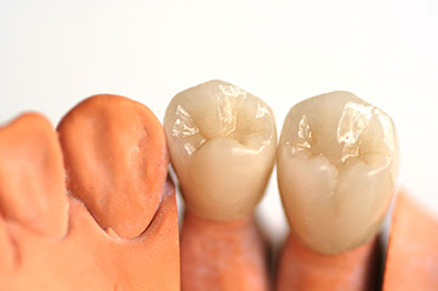 M. Derek Davis, DDS | Dental Fillings, Implant Dentistry and Dental Bridges