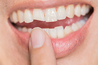 M. Derek Davis, DDS | Sedation Dentistry, Teeth Whitening and Dental Cleanings