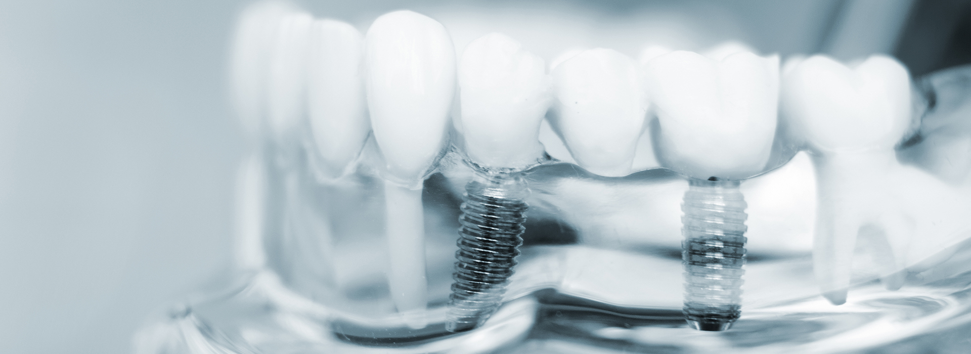 M. Derek Davis, DDS | Preventative Program, Root Canals and Implant Dentistry